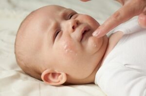 Baby's Eczema