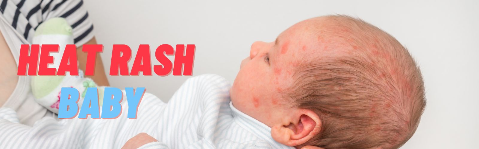 Heat Rash Baby Baby Mag February 2023